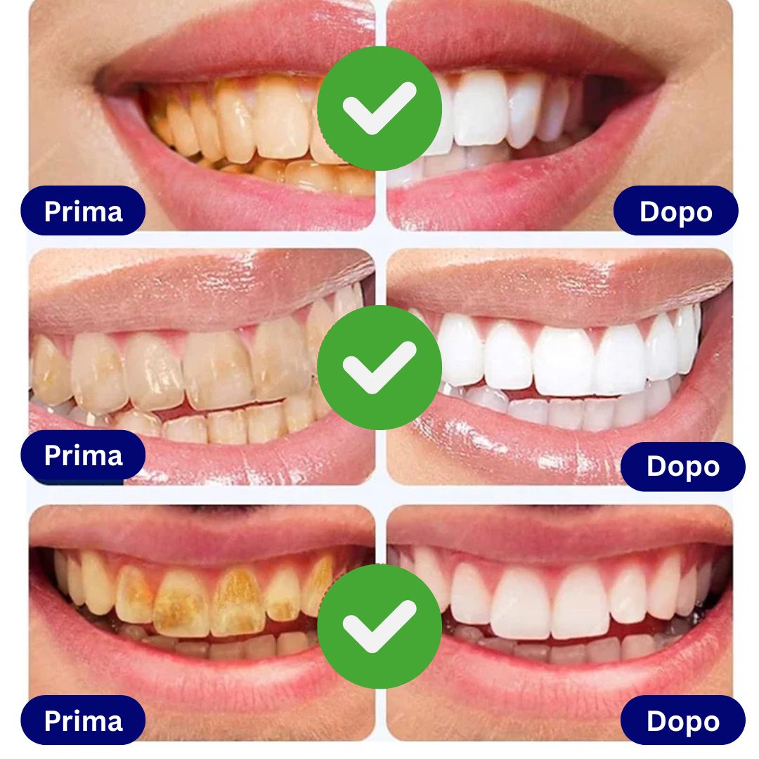 PureSmile Penna Sbiancante