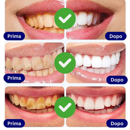 PureSmile Penna Sbiancante